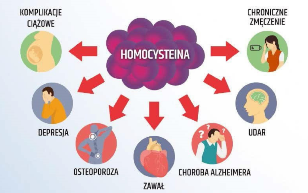 Homocysteina badanie